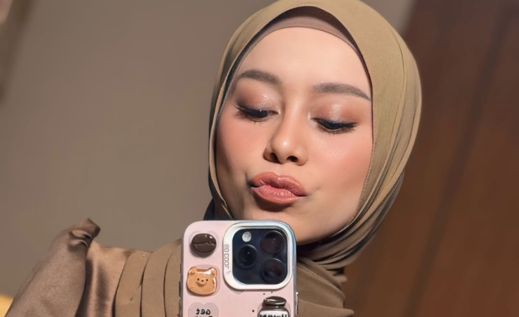 Lesty Kejora Pernah Kutuan, Istri Rizky Billar Ungkap Penyebabnya!