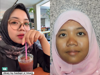 Heboh Wajah Nurul Sahara Sebelum Glowing, Beda Banget sama Penampilannya Sekarang